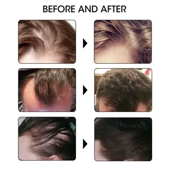 7 Dienų Greitą Plaukų Augimą iš Esmės Aliejus, Imbieras Plaukų Augimo Serumas Maitina Sušvelninti Gydymo Plaukų Slinkimas Remonto Pažeistų Plaukų 20ml