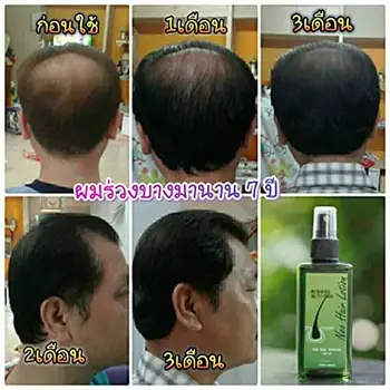 Neo Plaukų Losjonas 120ml skersmens Plaukų Gydymas, Plaukų Šaknų Maistinių medžiagų Anti-Loss Barzda Atauga Originalus Tailandas