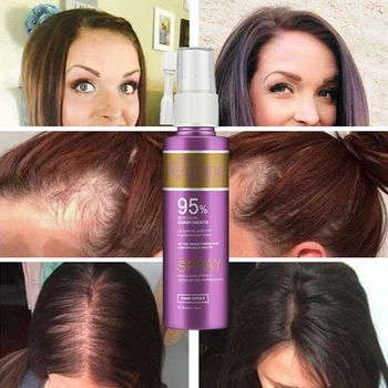 Plaukai Atauga Purškimo Anit Plaukų Slinkimas Aktualūs Gydymo Retinimo Plaukų, 3 Vnt Hiar Priežiūros Produktas Vyrų/Moterų Plaukų Augimo Esmė
