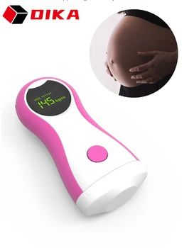 Vaisiaus Doplerio Kūdikio Stebėjimo Ultragarso Vaisiaus Echolotai Garso Širdies Ritmo Detektorių Namų Nėščioms 2.5 MHz, Ne Radiacija